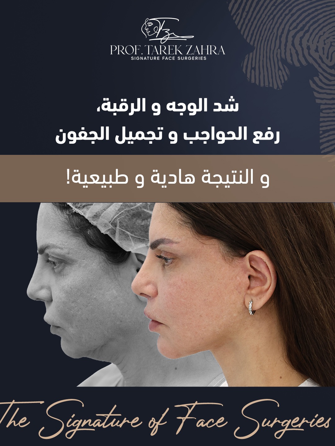 نتائج شد الوجه والرقبة